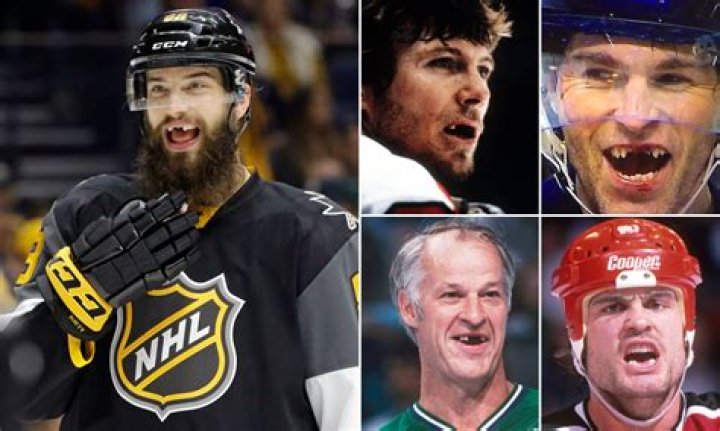 Do hockey players get their teeth knocked out?
