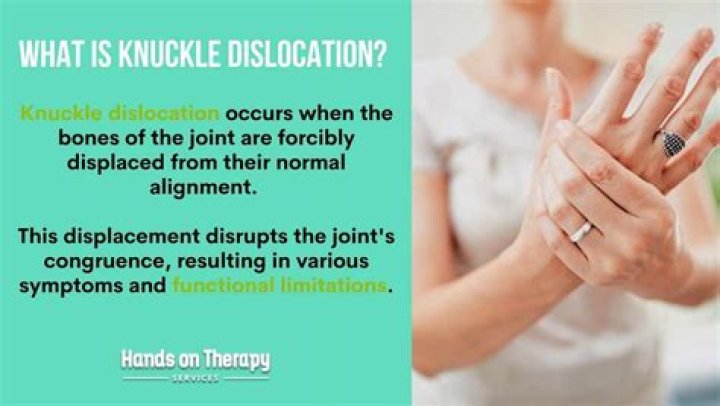 Do knuckles hurt more than gloves?