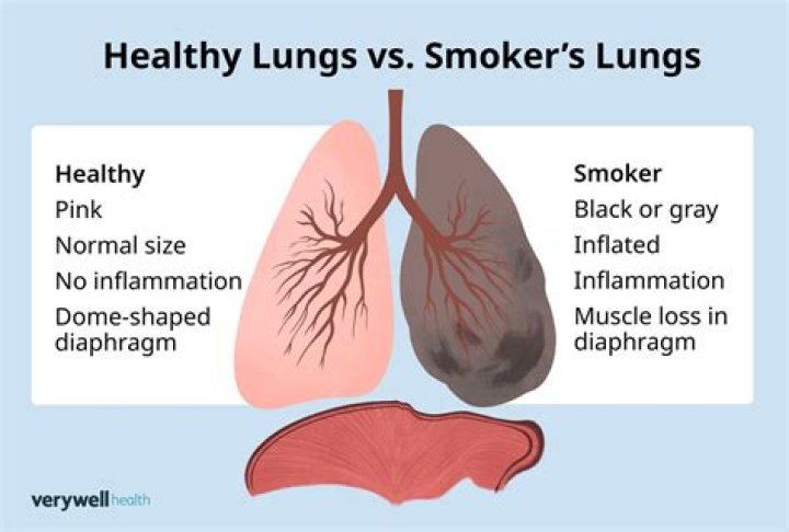 How do you fight a smoker?