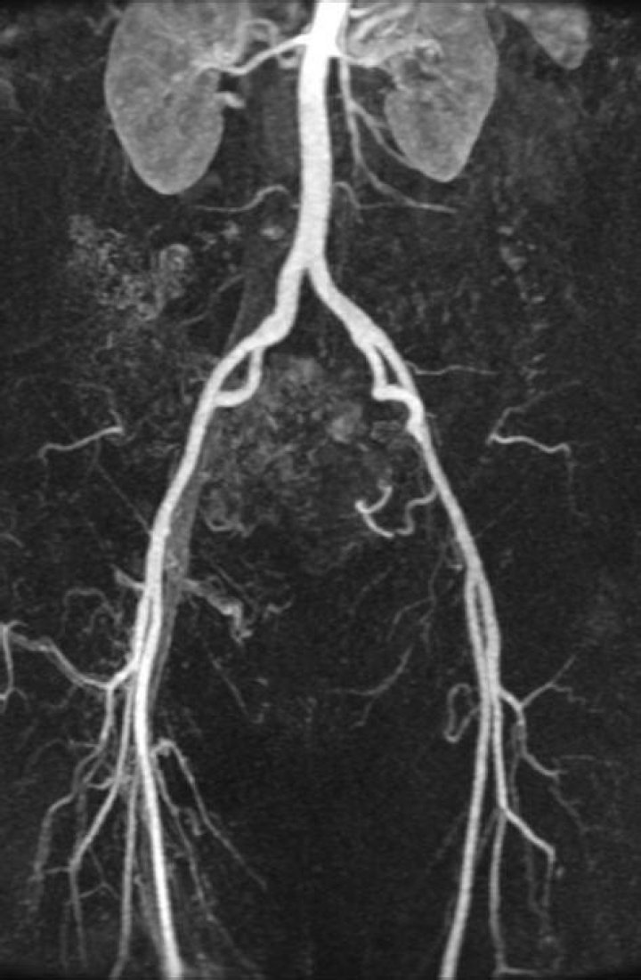 How hard is Weber's shot?