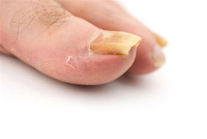 Is Cryophobia common?