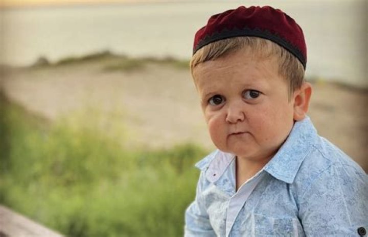 Is Hasbulla a midget?