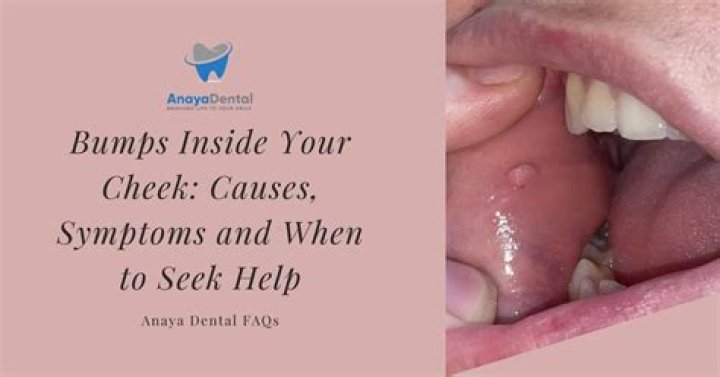 What are the bumps on ski slopes called?