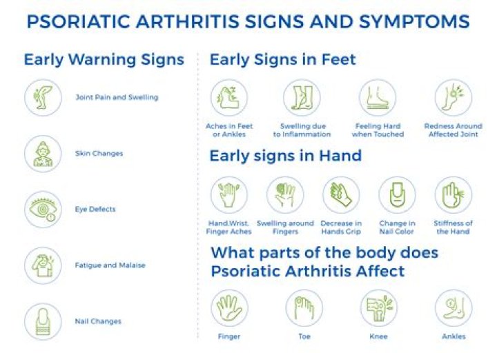 What are the early warning signs of psoriatic arthritis?