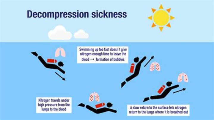 What is Chi sickness?