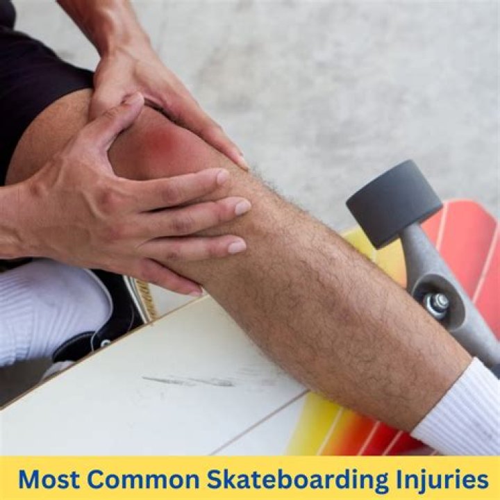 What is the most common skateboard injury?