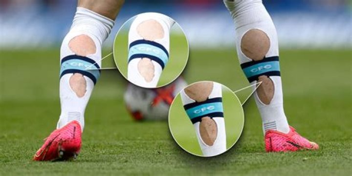 Why do footballers tape their knees?