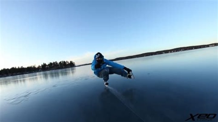 Why do ice skates hurt?